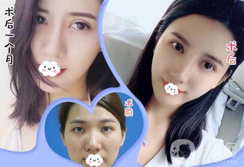 深圳鵬愛(ài)整形醫(yī)院價(jià)格表在線搶先看 更多專家坐診等你來(lái)！