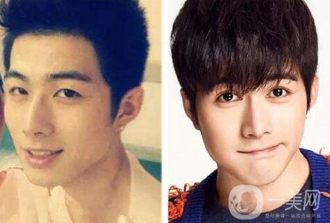 男生割雙眼皮會變帥嗎？