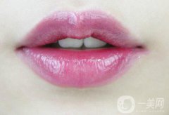 豐唇需要多少錢 豐唇價格詳解