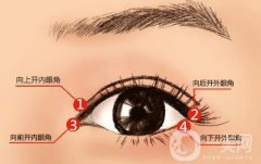 什么人適合做開眼角手術(shù)？