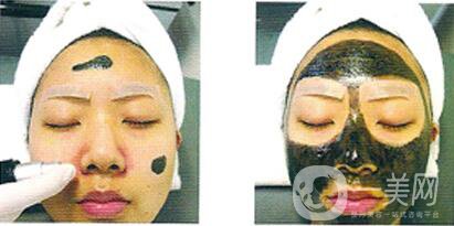 黑臉娃娃做幾次 黑臉娃娃*果到底怎么樣