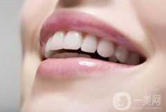 非金屬烤瓷牙價格一般是多少？