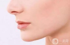 廣東鼻骨矯正術(shù)大概多少錢 廣東鼻骨矯正術(shù)價格分析