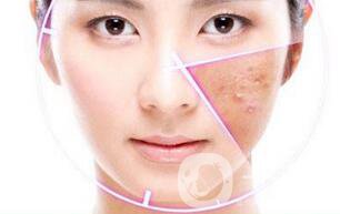 做果酸換膚多少錢一次 果酸換膚具體價(jià)格