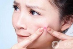 像素激光祛痘疤費(fèi)用一般要多少錢？