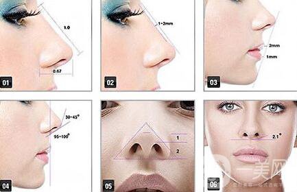 *術(shù)后注意事項(xiàng) *整形術(shù)后如何護(hù)理