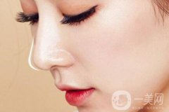 隆鼻山根多久消腫定型 隆鼻后多久完全恢復