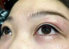 洗眼線多少錢 洗眼線具體價格多少