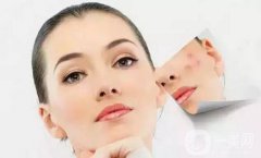 做一次果酸換膚大概需要多少錢？