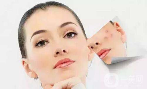 做一次果酸換膚大概需要多少錢？