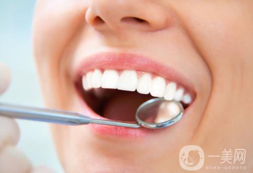 做美容冠矯正齙牙多少錢？