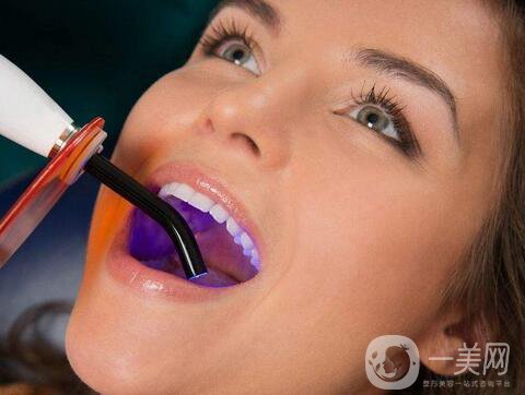 皓齒美白牙齒多少錢 皓齒美白潔牙費(fèi)用