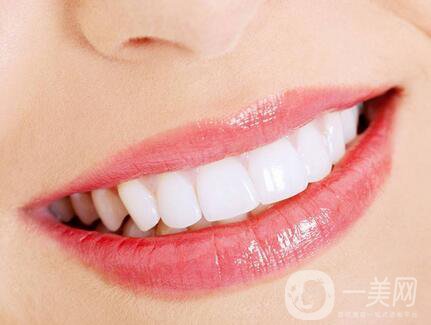 皓齒美白牙齒多少錢 皓齒美白潔牙費(fèi)用