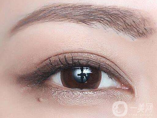 開眼角多少錢？ 開眼角價格是多少？