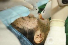 thermage熱瑪吉緊膚一次多少錢？