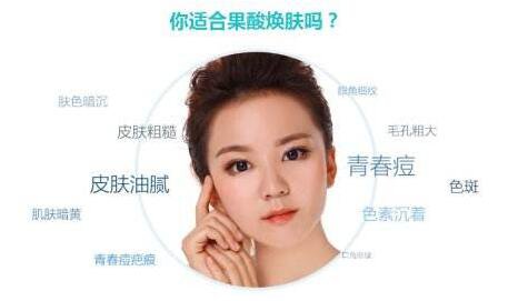 果酸換膚的*果 果酸換膚*果怎么樣