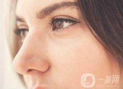 駝峰鼻手術(shù)價格 駝峰鼻手術(shù)多少錢