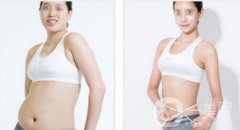 水動(dòng)力溶脂減肥靠譜嗎 水動(dòng)力溶脂減肥怎么樣