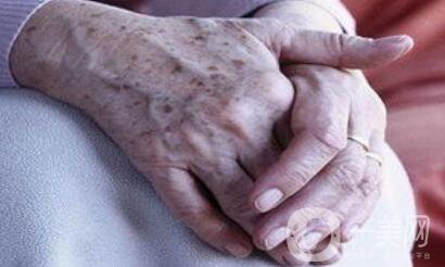 老年斑的形成 身上長(zhǎng)老年斑是什么原因