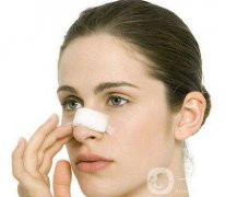 朝天鼻矯正價(jià)格 朝天鼻矯正要多少錢