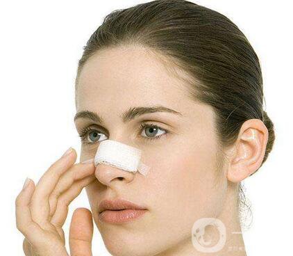 朝天鼻矯正價格 朝天鼻矯正要多少錢