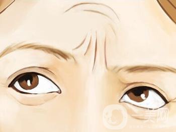 怎么去抬頭紋比較*果？