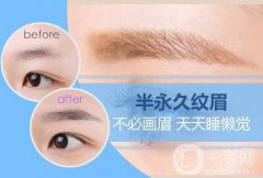 繡眉需要多少錢(qián) 繡眉的價(jià)格是多少