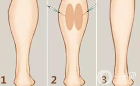 **的價(jià)格 **費(fèi)用介紹