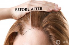 鄭州頭發(fā)移植醫(yī)院信息介紹 鄭州頭發(fā)移植醫(yī)院介紹