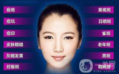 彩光嫩膚祛斑多少錢(qián) 彩光嫩膚祛斑價(jià)格介紹