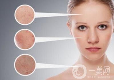 *風范祛斑*果怎么樣？