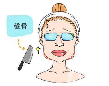 下頜角截骨手術(shù)頭套戴多久 恢復(fù)期要多久？