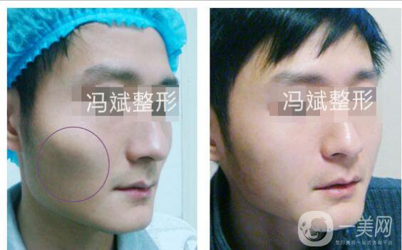 北京東方和諧馮斌整形價格表2018國慶特惠出爐