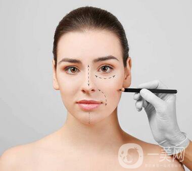 駝峰鼻矯正注意事項(xiàng)有哪些？