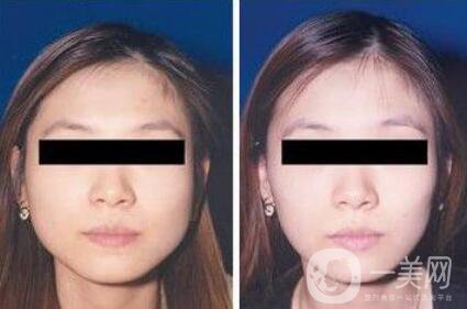 打完*能維持多長(zhǎng)時(shí)間