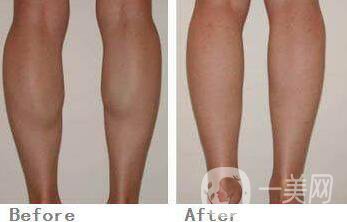 深圳**價(jià)格是多少