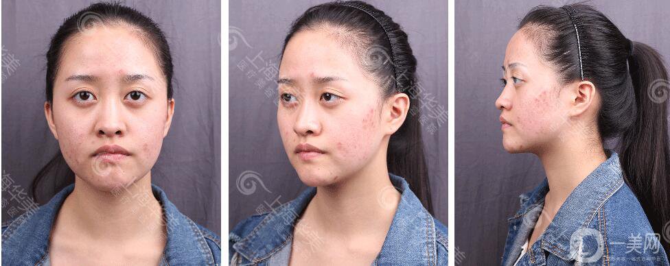 上海華美整形價(jià)格表2018發(fā)布 高級(jí)臉專(zhuān)屬定制項(xiàng)目曝光