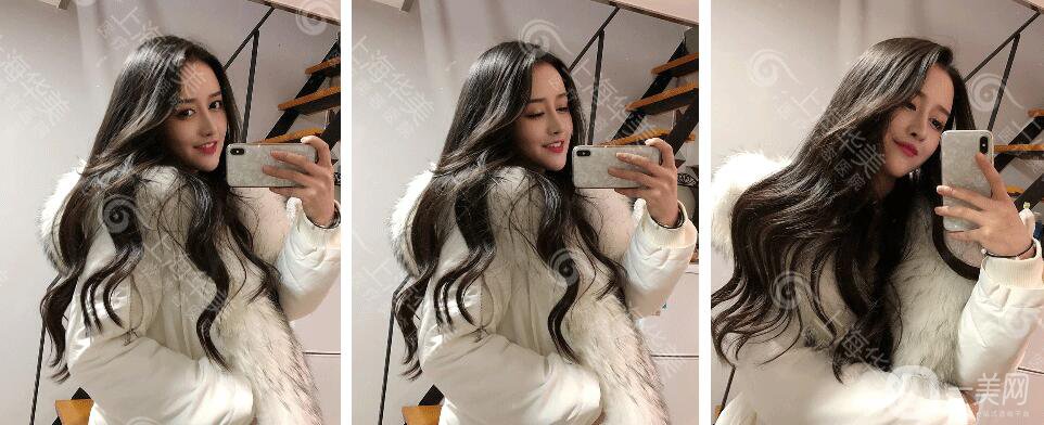 上海華美整形價(jià)格表2018發(fā)布 高級(jí)臉專(zhuān)屬定制項(xiàng)目曝光