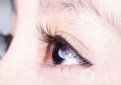 深圳移植睫毛大概多少錢(qián)