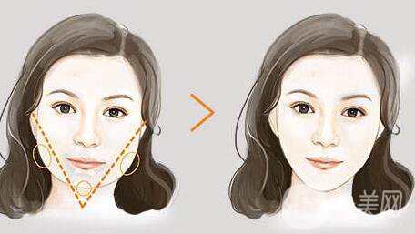 *價格一般多少錢？