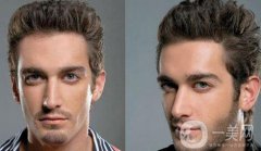 植鬢角價(jià)格要多少錢(qián)