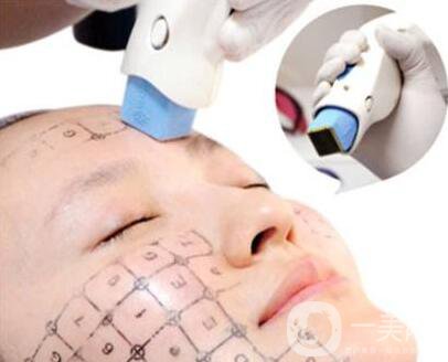 熱瑪吉除皺價(jià)格是多少錢(qián)？