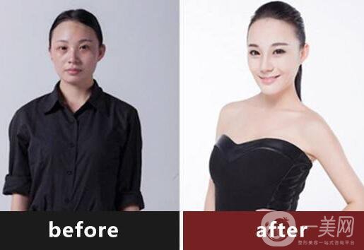 復合彩光調節(jié),*果