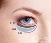 吸脂去下眼瞼眼袋怎么樣？