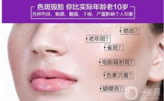 激光祛斑的危害與果分別有哪些？