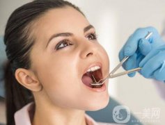 成都種植牙信息介紹？