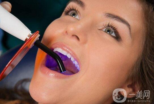 *潔牙注意事項(xiàng)有哪些？