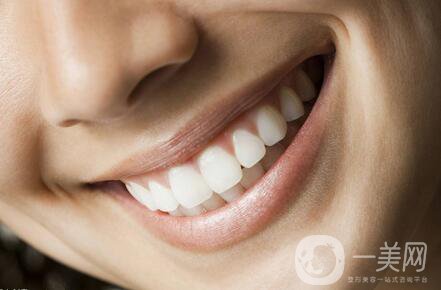 廣州種植牙價(jià)格是多少？