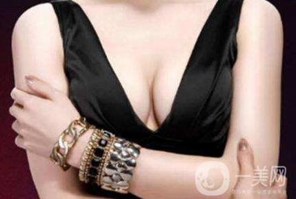 法國(guó)es假體隆胸,價(jià)格