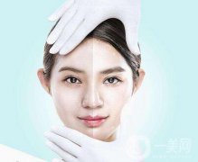 像束激光美白嫩膚功有哪些？